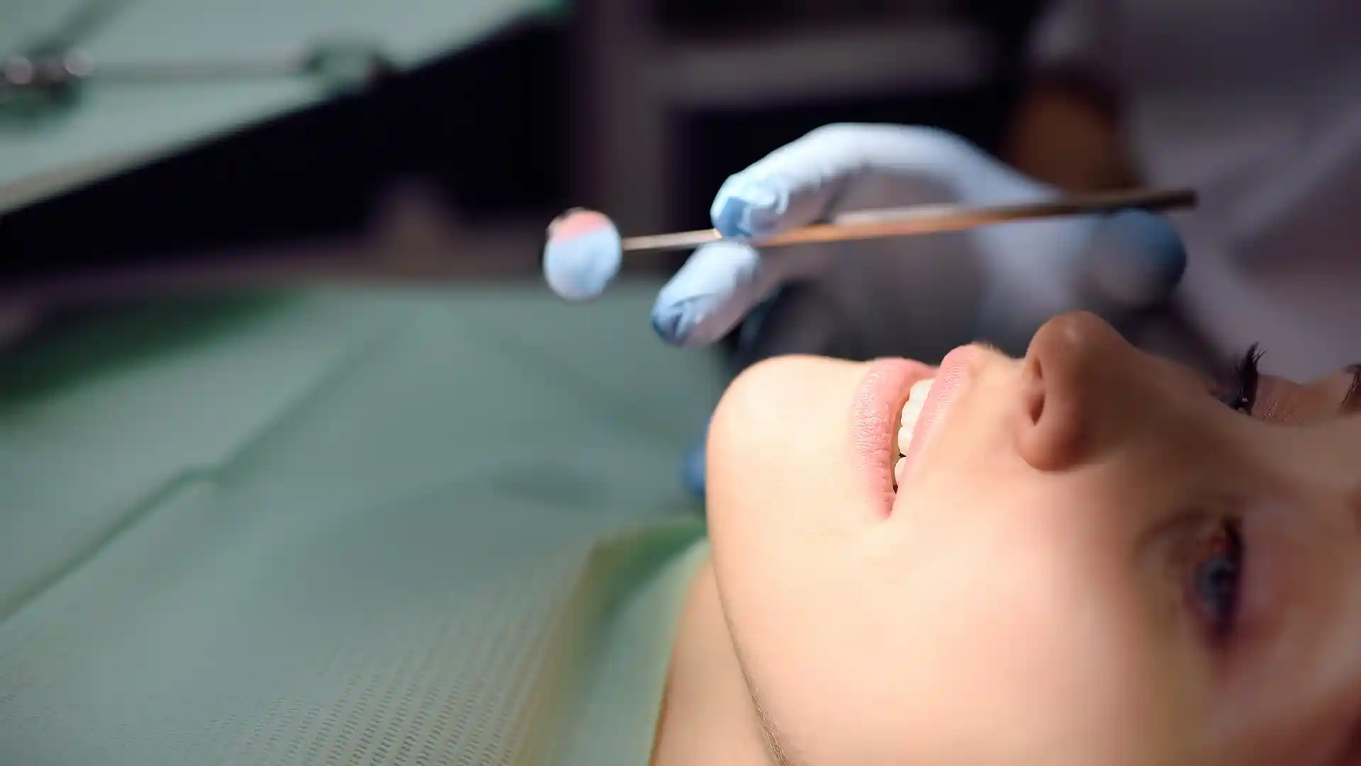 Kanal Tedavisi Olmadan Diş Kaplaması Yaptırabilir misiniz?